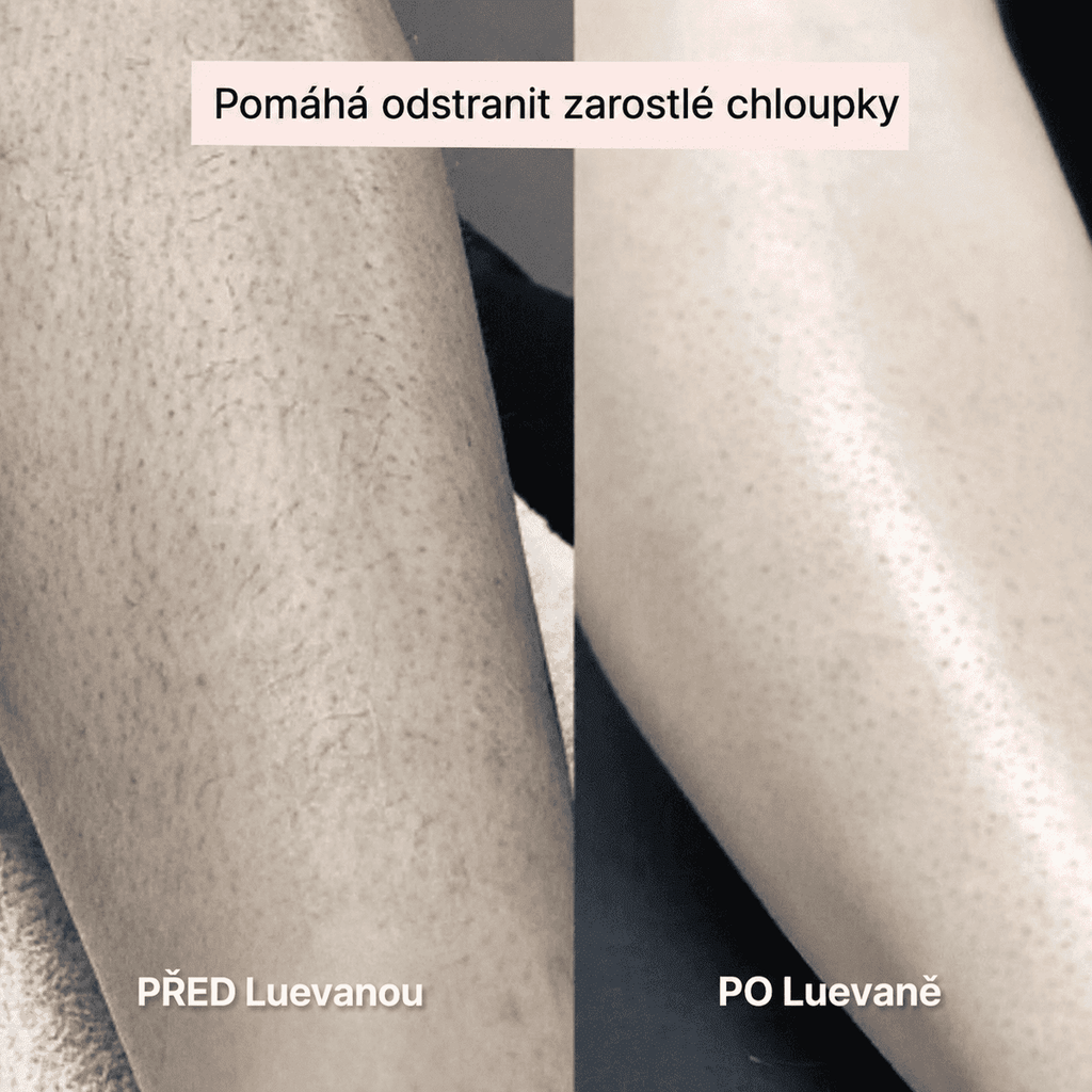 Mierava™ – Dámský holicí strojek 2 v 1
