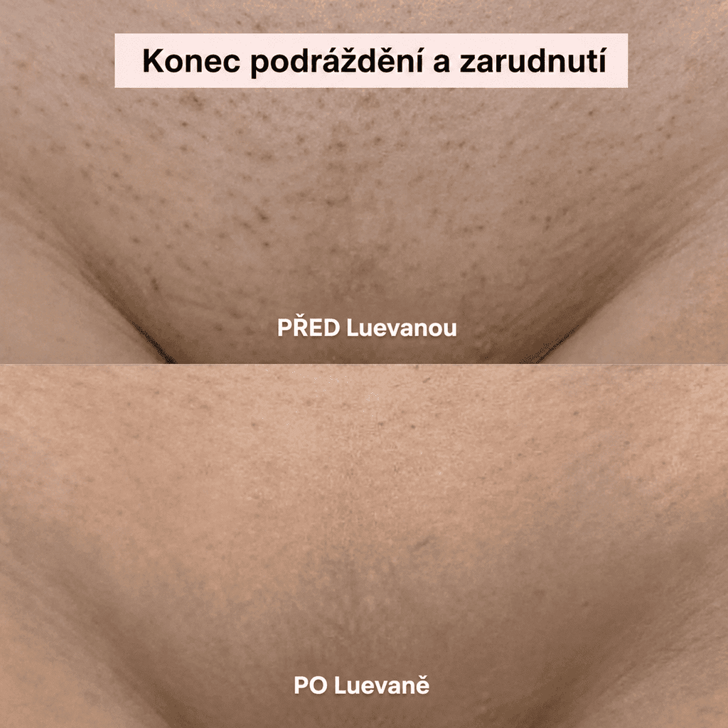 Mierava™ – Dámský holicí strojek 2 v 1