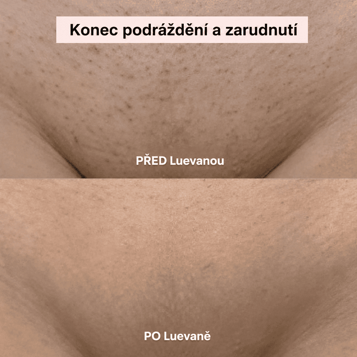Mierava™ – Dámský holicí strojek 2 v 1