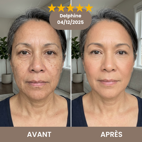  Translation missing: cs.placeholder.placeholder_image_alt
